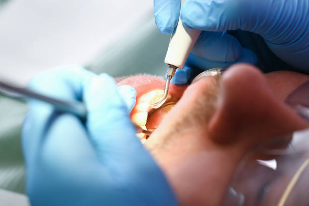 Best Emergency Denture Repair in Roslyn Estates, NY